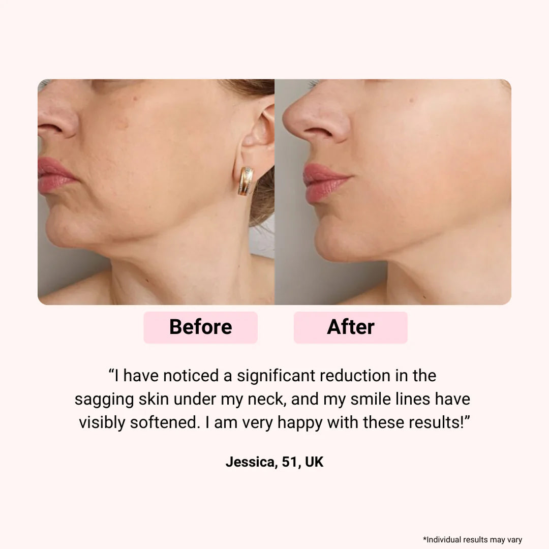 LumieNyxx 5-in-1 LED Face Mask for Anti-Ageing & Radiant Skin