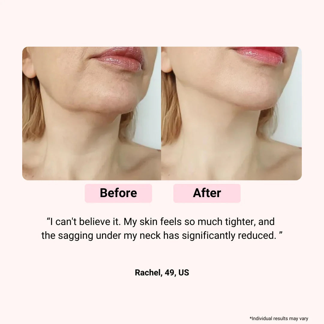 LumieNyxx 5-in-1 LED Face Mask for Anti-Ageing & Radiant Skin